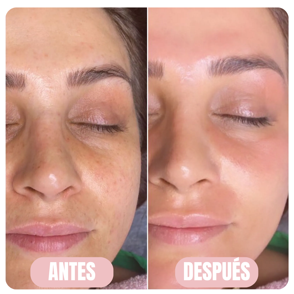 Aura - Bálsamo de Colágeno