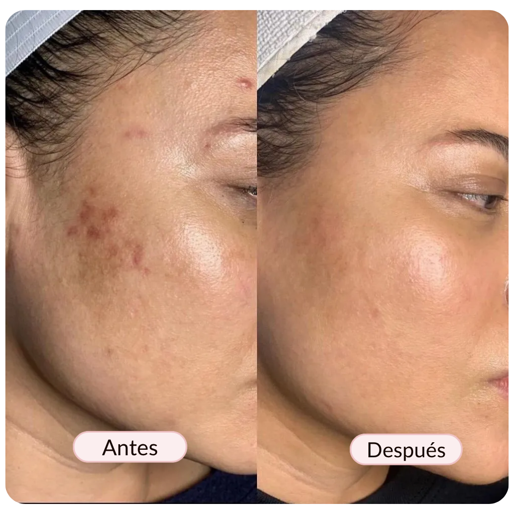 Mascarilla Nocturna con Colágeno