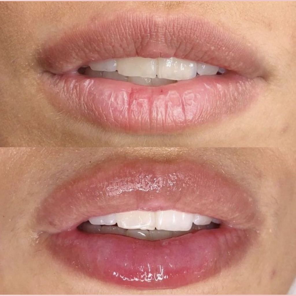 Colágeno Labial Noche & Día